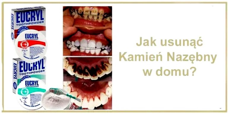 Jak łatwo i bez stresu zdjąć kamień dekoracyjny ze ściany?