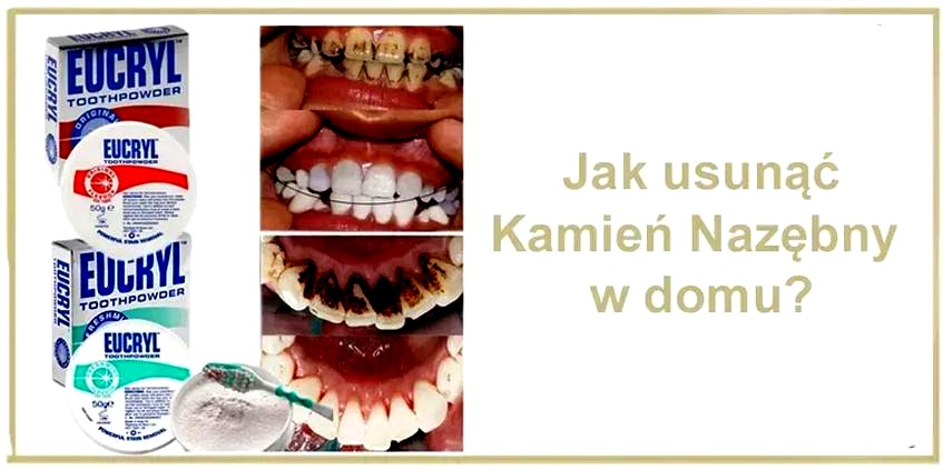 Jak łatwo i bez stresu zdjąć kamień dekoracyjny ze ściany?